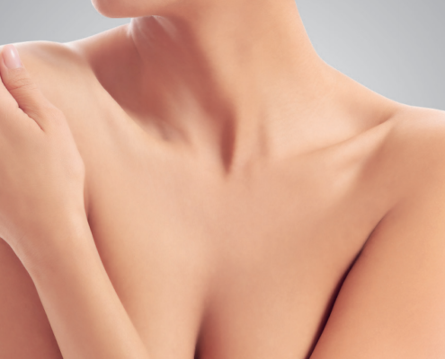 Lifting non chirurgico del décolleté