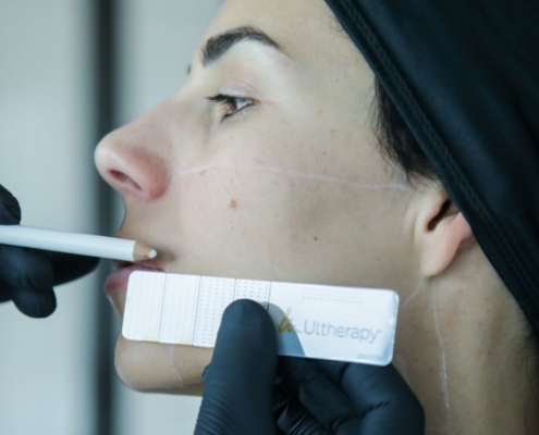 Lifting non chirurgico e lifting chirurgico tutte le differenze per un ringiovanimento viso su misura